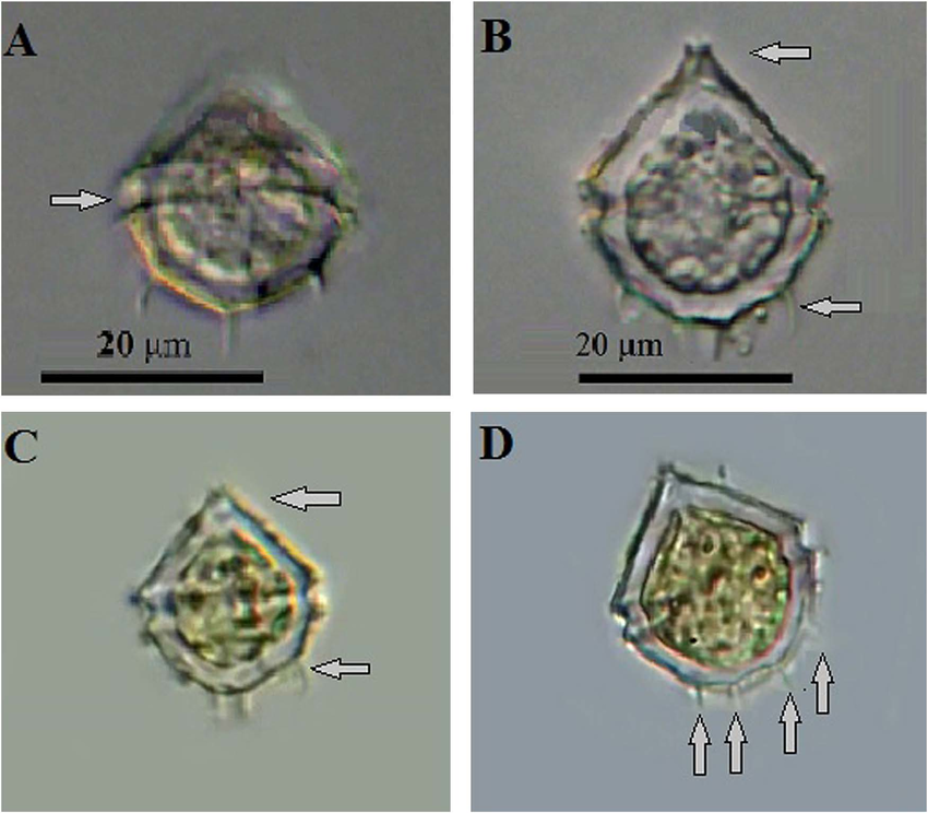 Light microscopy images of Protoperidinium quinquecorne from the ...