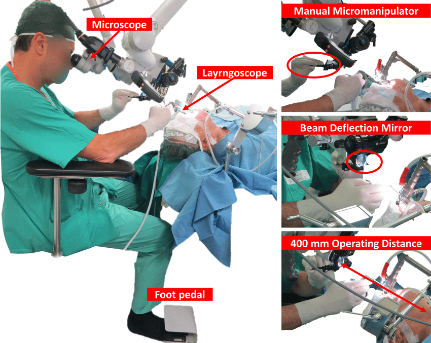 State Of The Art Setup In Transoral Laser Microsurgery The Setup Download Scientific Diagram