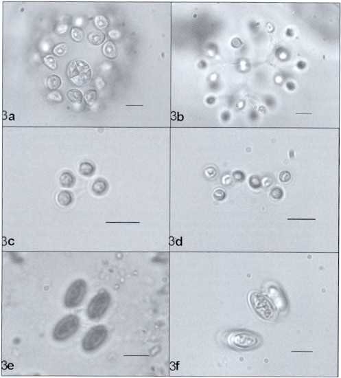 a-f. Light micrographs of taxa of Dictyosphaerium and Quadricoccus ...