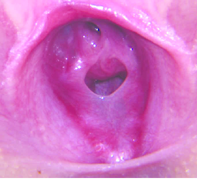 Vagina Close Up Hymen