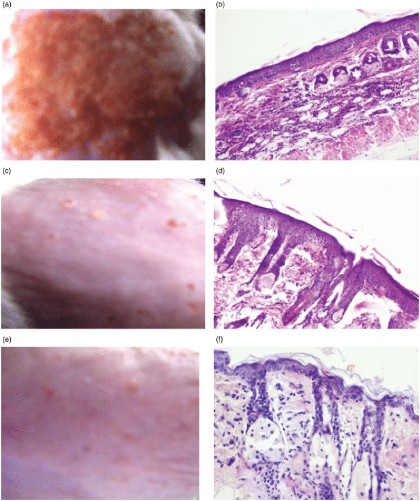 Photographs Showing A Macroscopic And B Histopathological