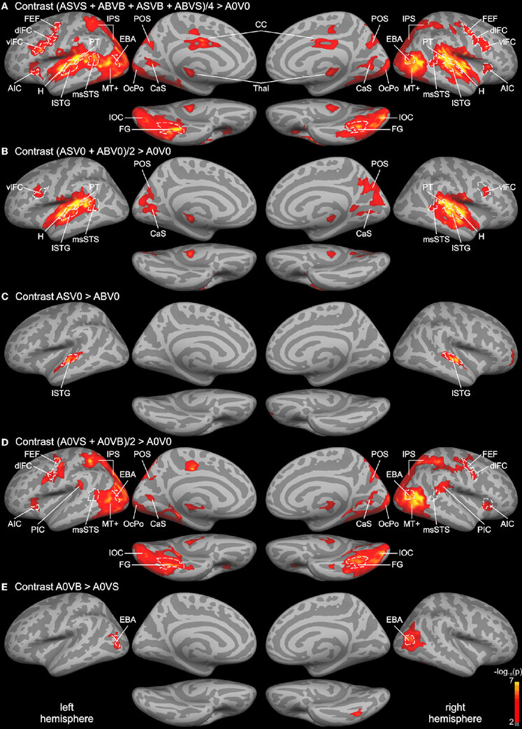 Whole Brain Group Analysis Statistical Parametric Maps