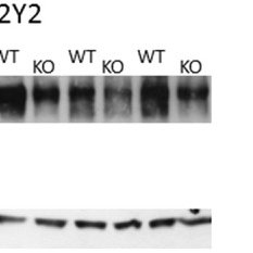 Western blot revealing similar expression of NKCC2 in P2Y2 receptor WT and KO (n = 3 each) inner stripe of outer medulla kidney tissue. Right side: The NKCC2 densitometric analysis is shown in reference to the equal dye loading control with β -actin.