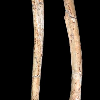 Pdf Bilateral Asymmetry Of The Forearm Bones As Possible Evidence Of Antemortem Trauma In The Stw 573 Australopithecus Skeleton From Sterkfontein Member 2 South Africa