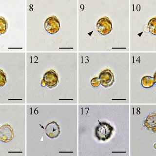 (PDF) Cyst morphology and germination in Heterosigma akashiwo ...