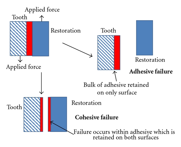 Adhesive and cohesive joint failures. | Download ...