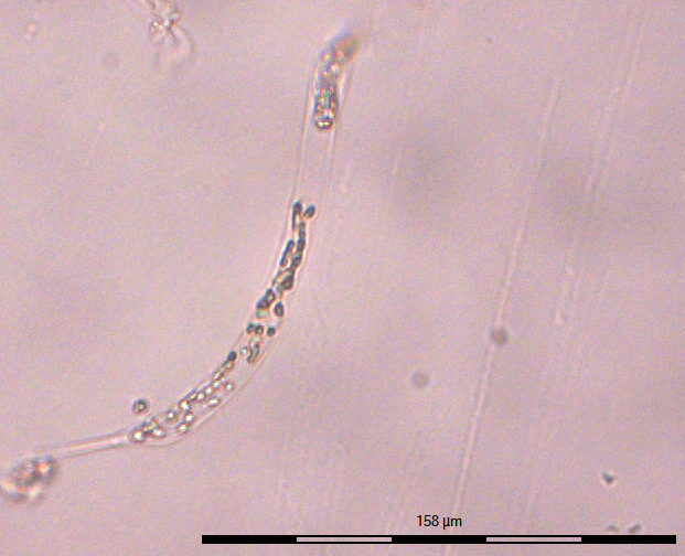 What are these plankton? | ResearchGate