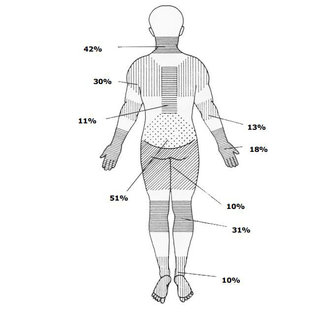Anatomic areas of pain | Download Scientific Diagram