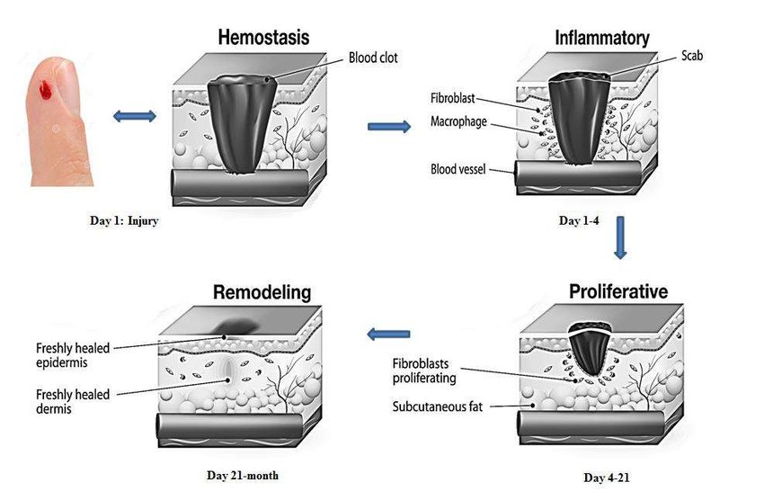 Wound Healing Phases  Schematic Diagram Elucidating The