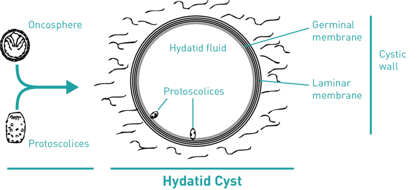 Structure Of The Hydatid Cyst