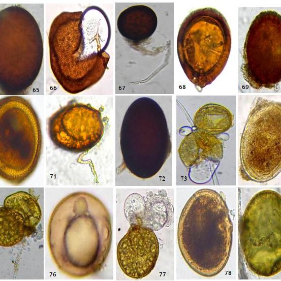 Endomycorrhizal spores isolated from the rhizosphere of mycorrhizal ...