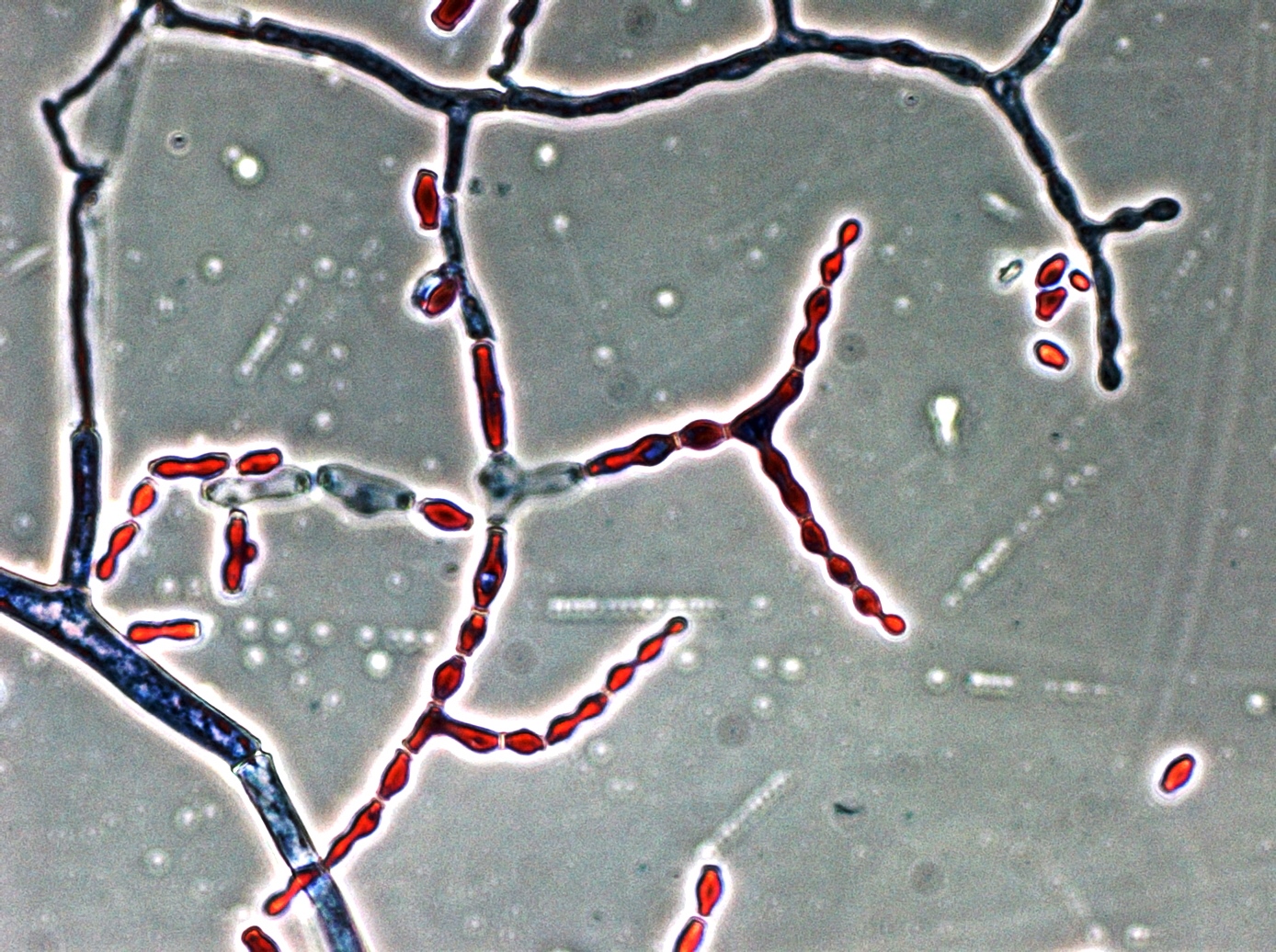 Споры candida. Нейроспора. Стул ROMAX microscopic. Fungi hyphae microscopic. Hyphae contamination in Cell Culture.