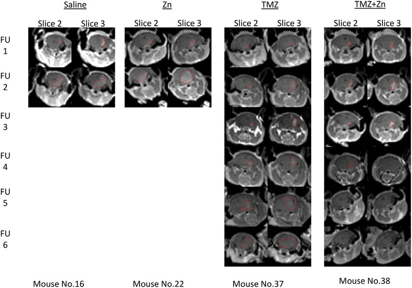 Tumor Detection By Contrast Enhanced T Weighted Mri Of Xenograft Mice