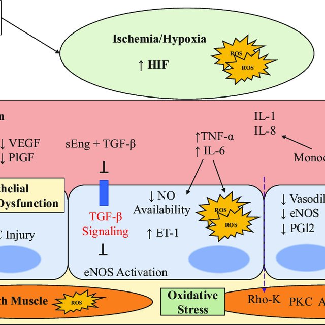 Endothelial dysfunction in Preeclampsia. Adapted from Moghaddas et al ...
