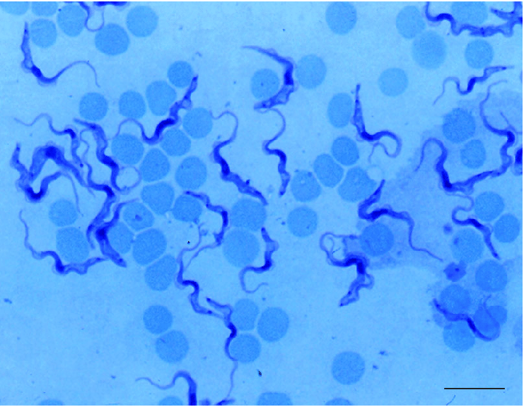 Trypanosoma Brucei Gambiense Giemsa Stained Trypomatigotes In A Thin Download Scientific