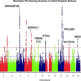 Zinc deficiency triggers hearing loss by reducing ribbon synapses of inner  hair cells in CBA/N mice - ScienceDirect