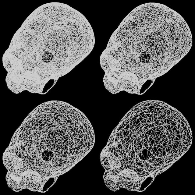 Undeformed (left) and deformed skull (right) of a fetal skull model ...