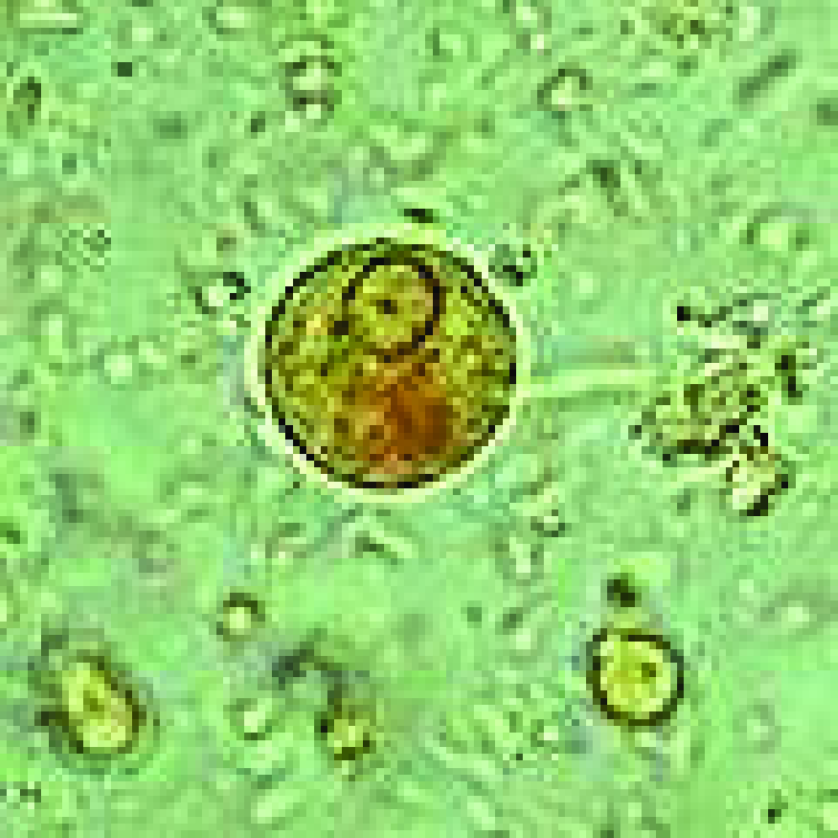 Entamoeba coli в кале. Цисты Entamoeba. Незрелая циста Entamoeba histolytica. Циста дизентерийной амебы. Дизентерийная амеба в Кале.