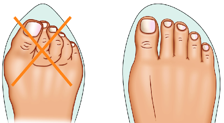 toe box