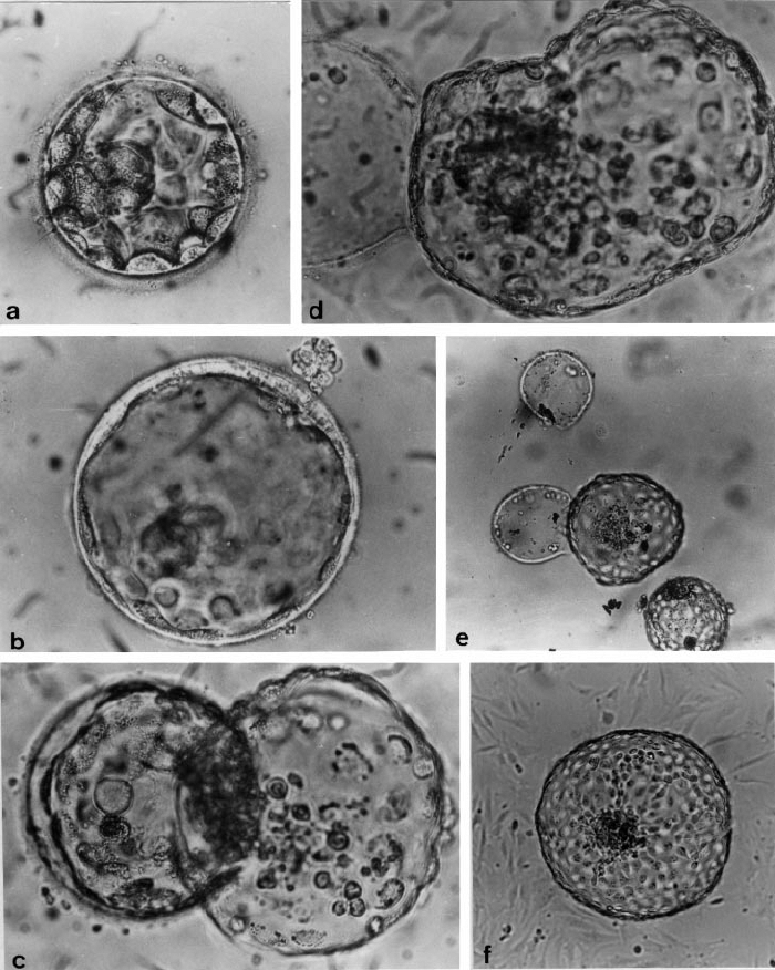 Natural hatching in vitro in human blastocysts. ( a ) Cavitating