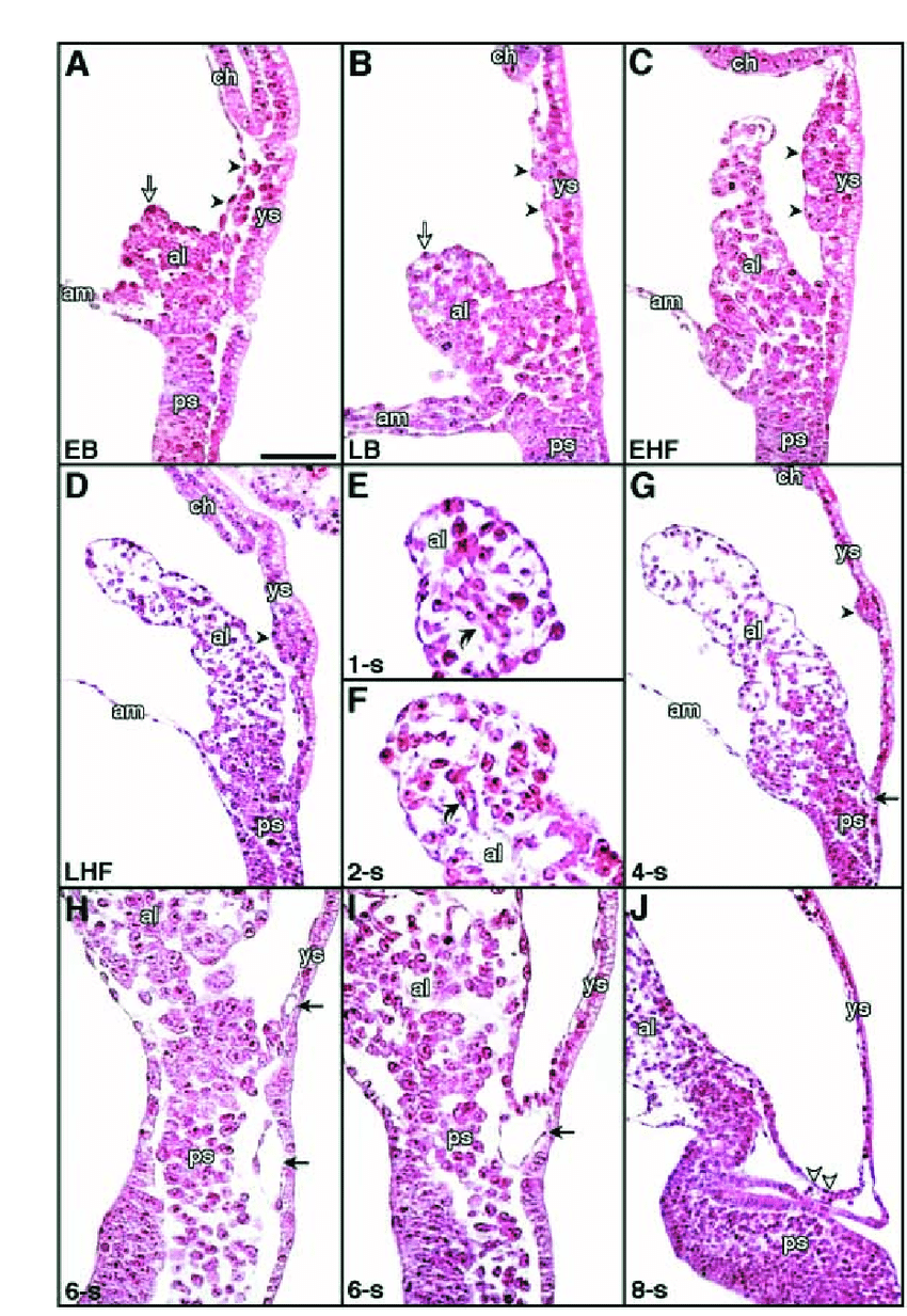 Morphological vascularization in the developing allantois.... | Download  Scientific Diagram