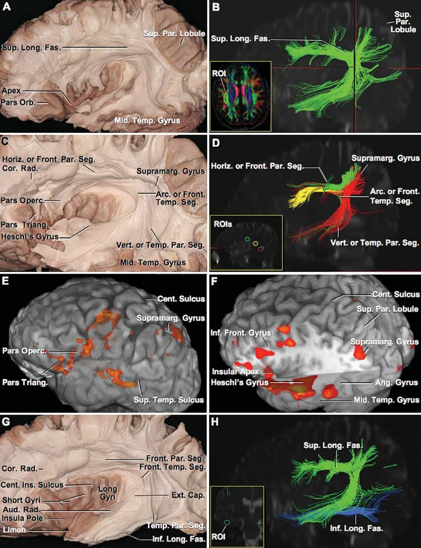 3D Modeling and Extended Reality Simulations of the Cross-sectional Anatomy  of the Cerebrum, Cerebellum, and Brainstem