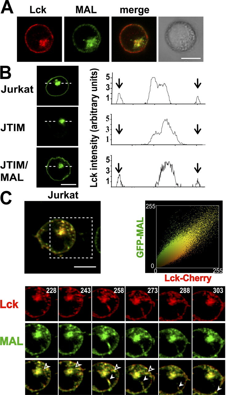 Steric exclusion and protein conformation determine the localization of  plasma membrane transporters