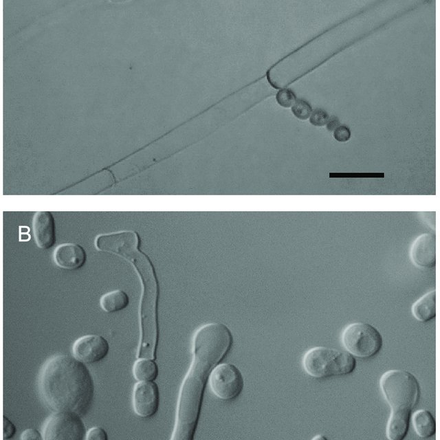 Morphology of Geotrichum sp. BUF11 observed by light microscopy ...