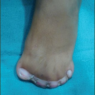 Leena sayed feet
