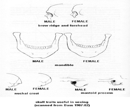 Diagram Shows The Difference Between Male And Female Skull