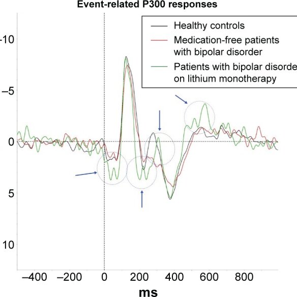 Event Related P300 Responses Of The Patients With Bipolar Disorder On