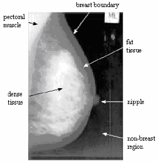 Figure 1, [Breast anatomy. The main parts]. - Breast Cancer