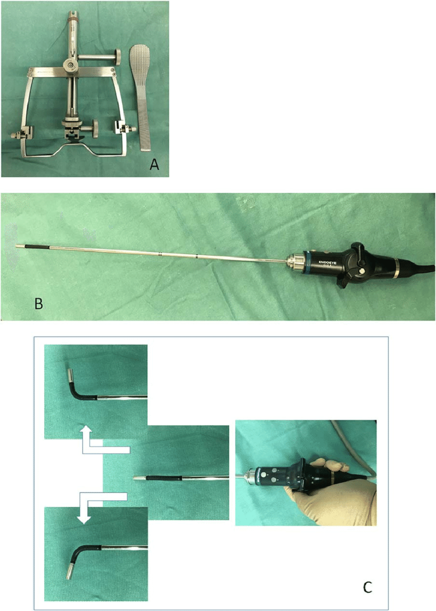 Surgical procedure A: FK-WO retractor. A short blade to expose the