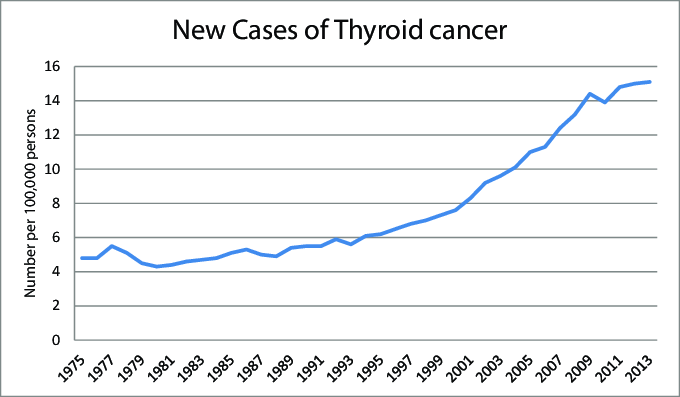 current research on thyroid cancer