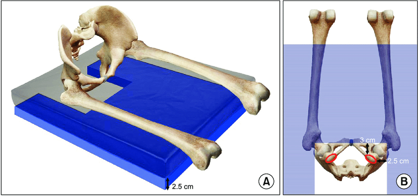 https://www.researchgate.net/publication/324981411/figure/fig1/AS:627083151671296@1526519682408/A-A-three-dimensional-image-of-the-pelvic-well-pad-blue-It-is-25-cm-thick-and-has-a.png
