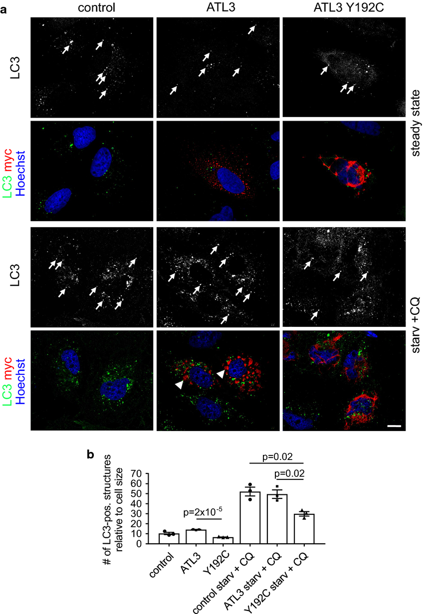 Atl3 Y192c Affects Autophagosome Formation Huh7 Cells Transfected With