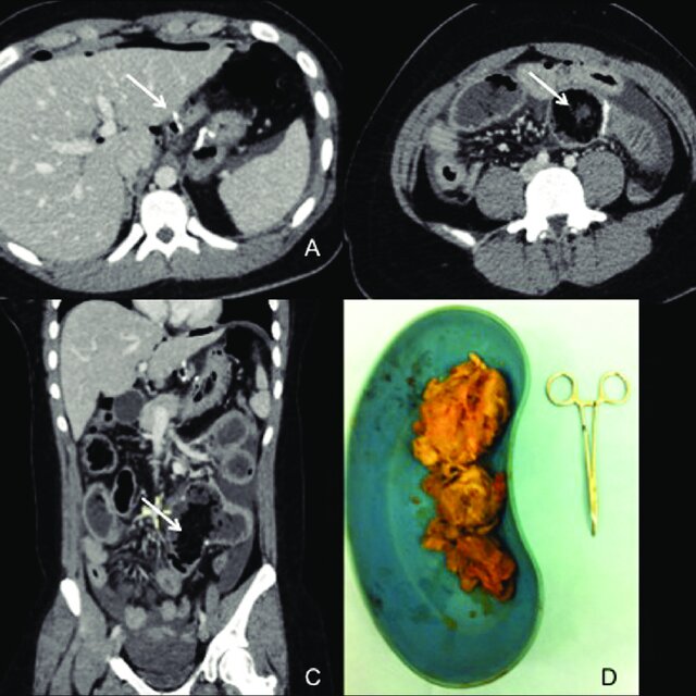 Ct Of The Abdomen And Pelvis With Intravenous Contrast A Axial