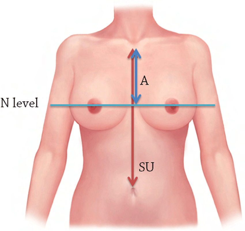 nipple position (frontal). SU: vertical distance from the sternal