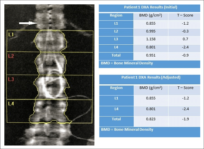 Radiology, DEXA and BMD Imaging