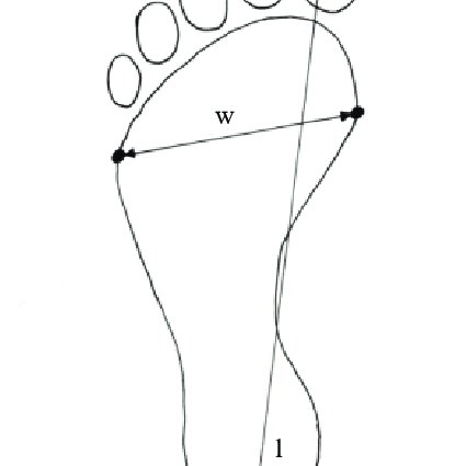 Wejsflog index -assessment of transversal foot arch [own drawing] l ...