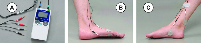 https://www.researchgate.net/publication/343662721/figure/fig1/AS:925445843337218@1597654891206/Transcutaneous-tibial-nerve-stimulation-TTNS-intervention-Pictures-of-the-TTNS-device.png