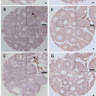 Morphology of Leydig cells in the testes after in vivo MCP-1 treatment.