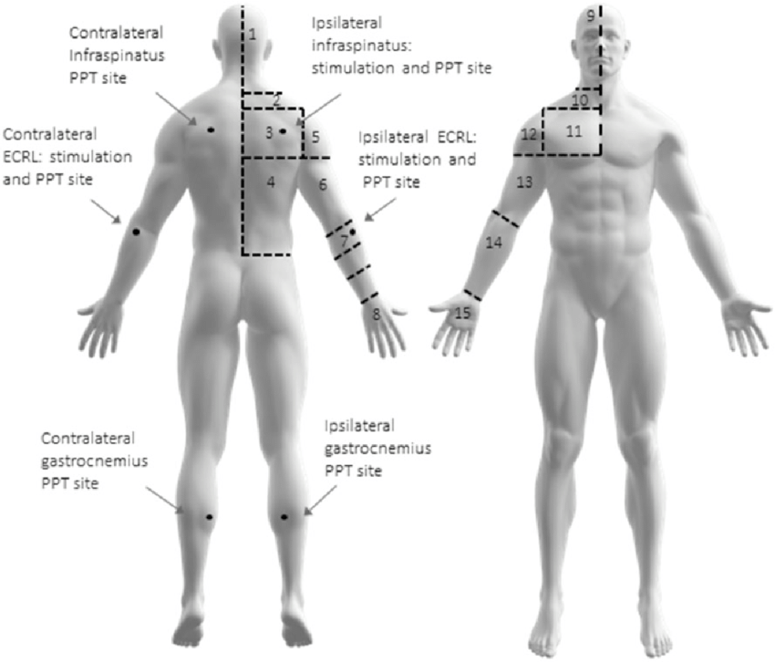 Body divisions used to quantify distribution of pain the... | Download Scientific Diagram