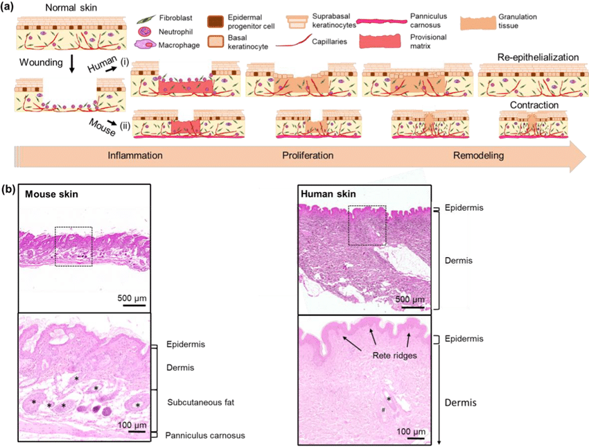 Phases of wound healing and differences between human and rodent skin ...