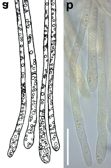 Octospora tucumanensis (Pezizales), a new bryophilous ascomycete on  Dimerodontium balansae (Bryophyta) from Argentina