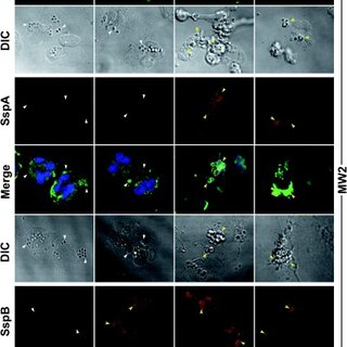 Hyperglycemia in Diabetic Skin Infections Promotes Staphylococcus aureus  Virulence Factor Aureolysin: Visualization by Molecular Imaging